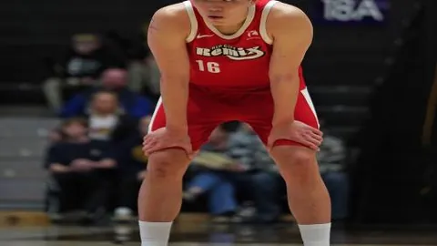 阿莫林报道：卢克-肖伤病更新，部位出现新变化